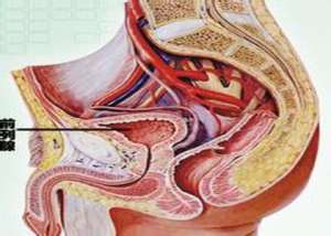 前列腺增生 手术期如何护理